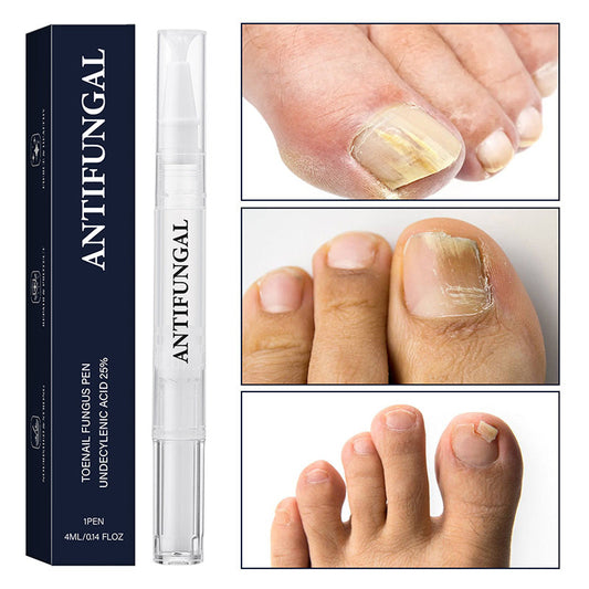 💅Pero na ošetření nehtů postižených plísní